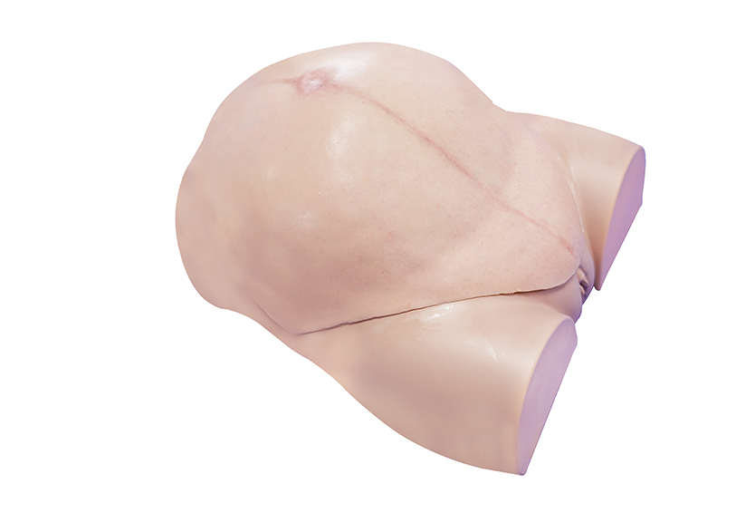 穿戴式剖宮產手術訓練模型